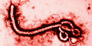 Ebola Virus. Image Credit: Huffington Post